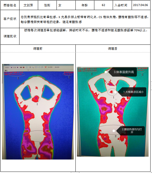 tmt热成像案例