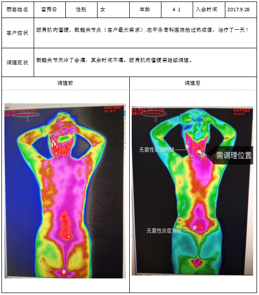 tmt热成像案例
