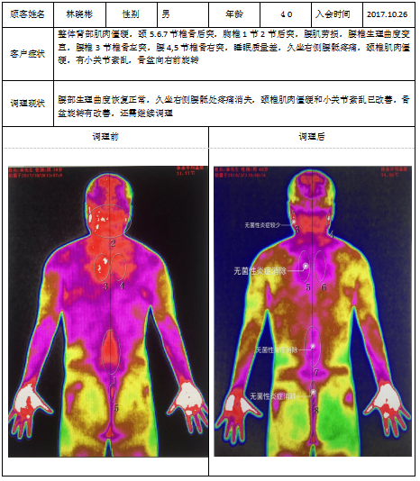 tmt热成像案例